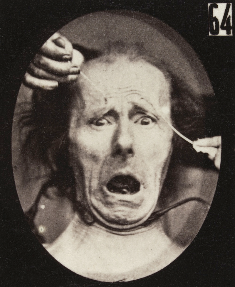 Illustration for article titled Terrifying, Century-Old Photographs from Neuroscience Experiments